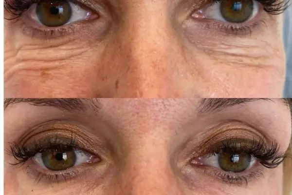 65-600x400