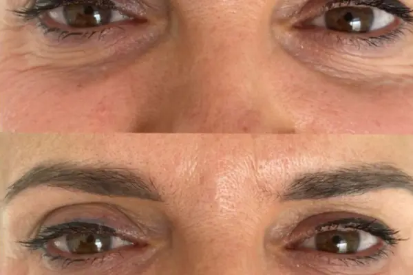 69-600x400