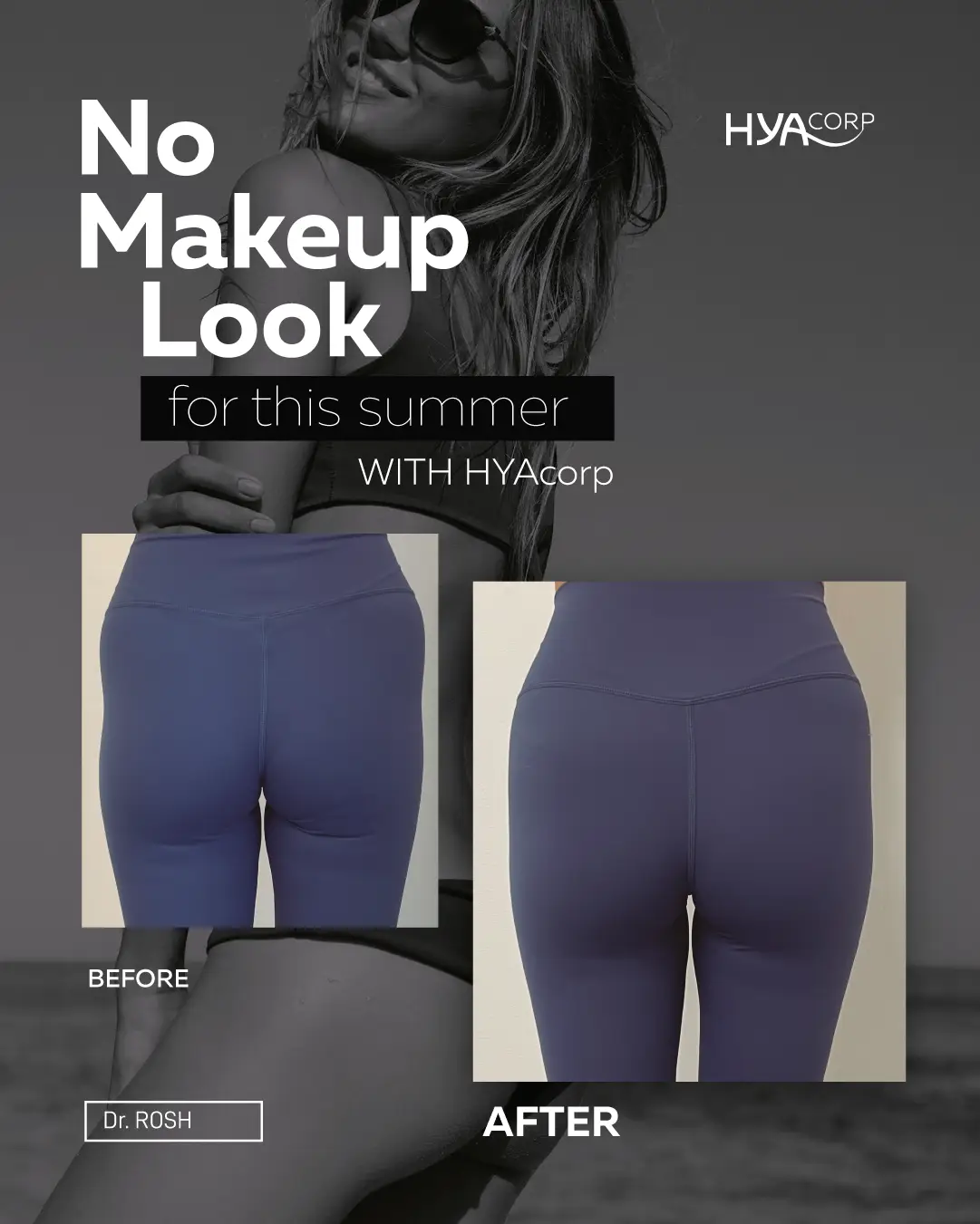 BEFORE & AFTER BODY (2)